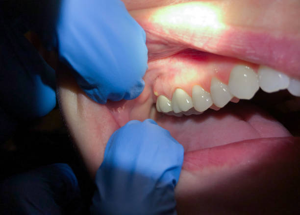  Southmont, NC Emergency Dentist Pros