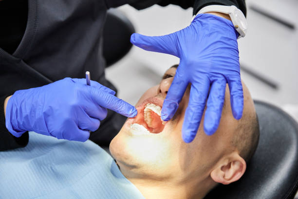 Best Emergency Dental Care for Abscessed Tooth in Southmont, NC