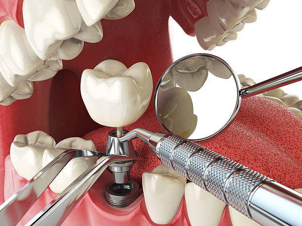 Best Urgent Dental Care for Toothache in Southmont, NC