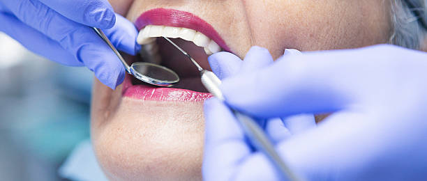 Best Emergency Dentist for Lost Fillings or Crowns in Southmont, NC